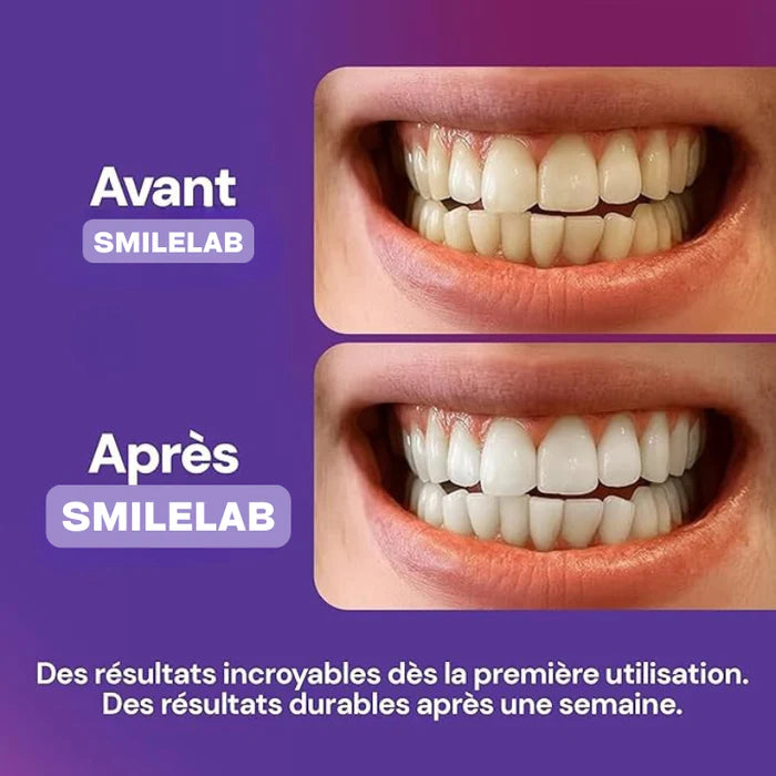 bandes violettes blanchissantes pour dents