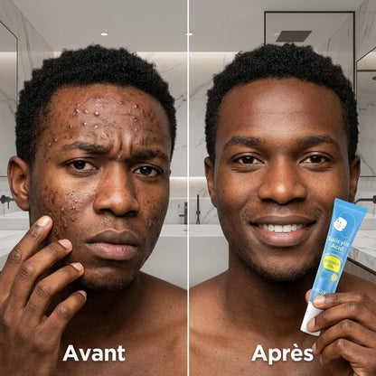 Gel Anti-Acné Traitant Rapide et Efficace pour Peau Lisse. Resserrer les pores, éliminer les cicatrices et taches  ✅ Résultats visibles dès les premières applications