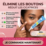 Charger l'image dans la galerie, Gel Anti-Acné Traitant Rapide et Efficace pour Peau Lisse. Resserrer les pores, éliminer les cicatrices et taches  ✅ Résultats visibles dès les premières applications
