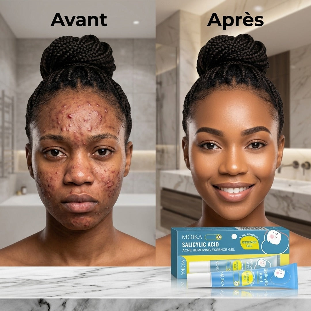 Gel Anti-Acné Traitant Rapide et Efficace pour Peau Lisse. Resserrer les pores, éliminer les cicatrices et taches  ✅ Résultats visibles dès les premières applications