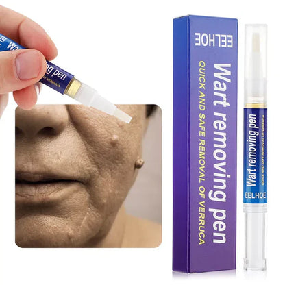 Stylo pour enlever les étiquettes de peau et les verrues