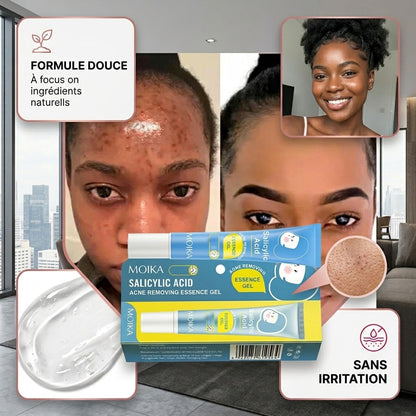Gel Anti-Acné Traitant Rapide et Efficace pour Peau Lisse. Resserrer les pores, éliminer les cicatrices et taches  ✅ Résultats visibles dès les premières applications